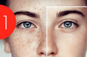 Etkili Çil Leke Benek Serumu LEKE -ÇİL - BEN GEÇİRİCİ SERUM