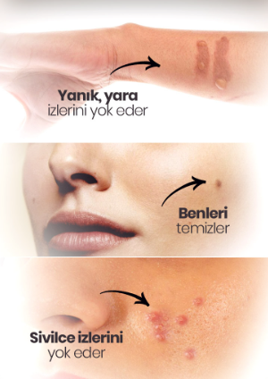 Etkili Çil Leke Benek Serumu LEKE -ÇİL - BEN GEÇİRİCİ SERUM